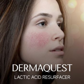 DermaQuest Lactic Acid Resurfacer / Our Treatment for Sensitive Skin