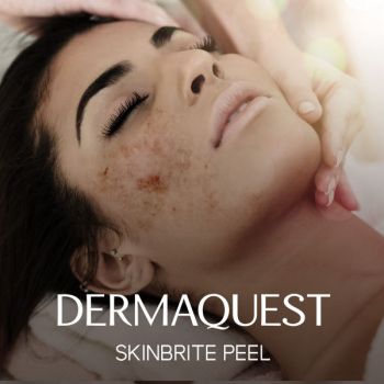 DermaQuest SkinBrite Peel / Brighter Day Peel